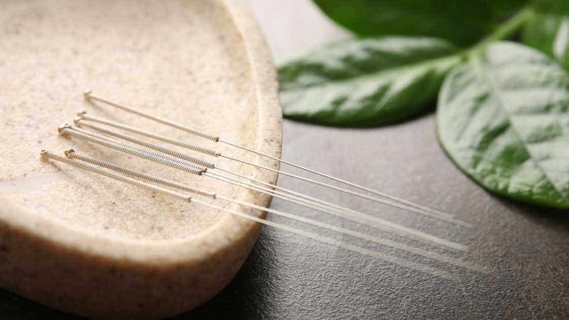 acupuncture needles acupuncture needles
